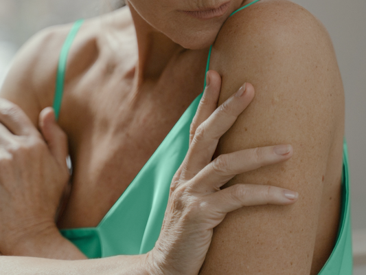 5 Benefits of CBD Oil for Shingles